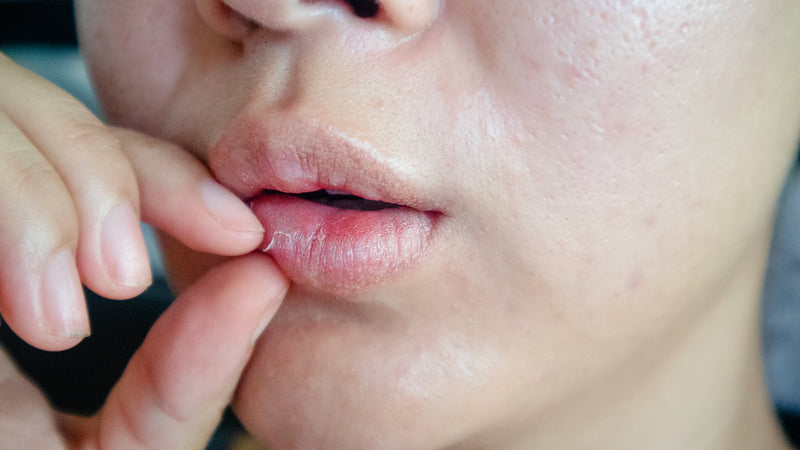 Trockene Lippen