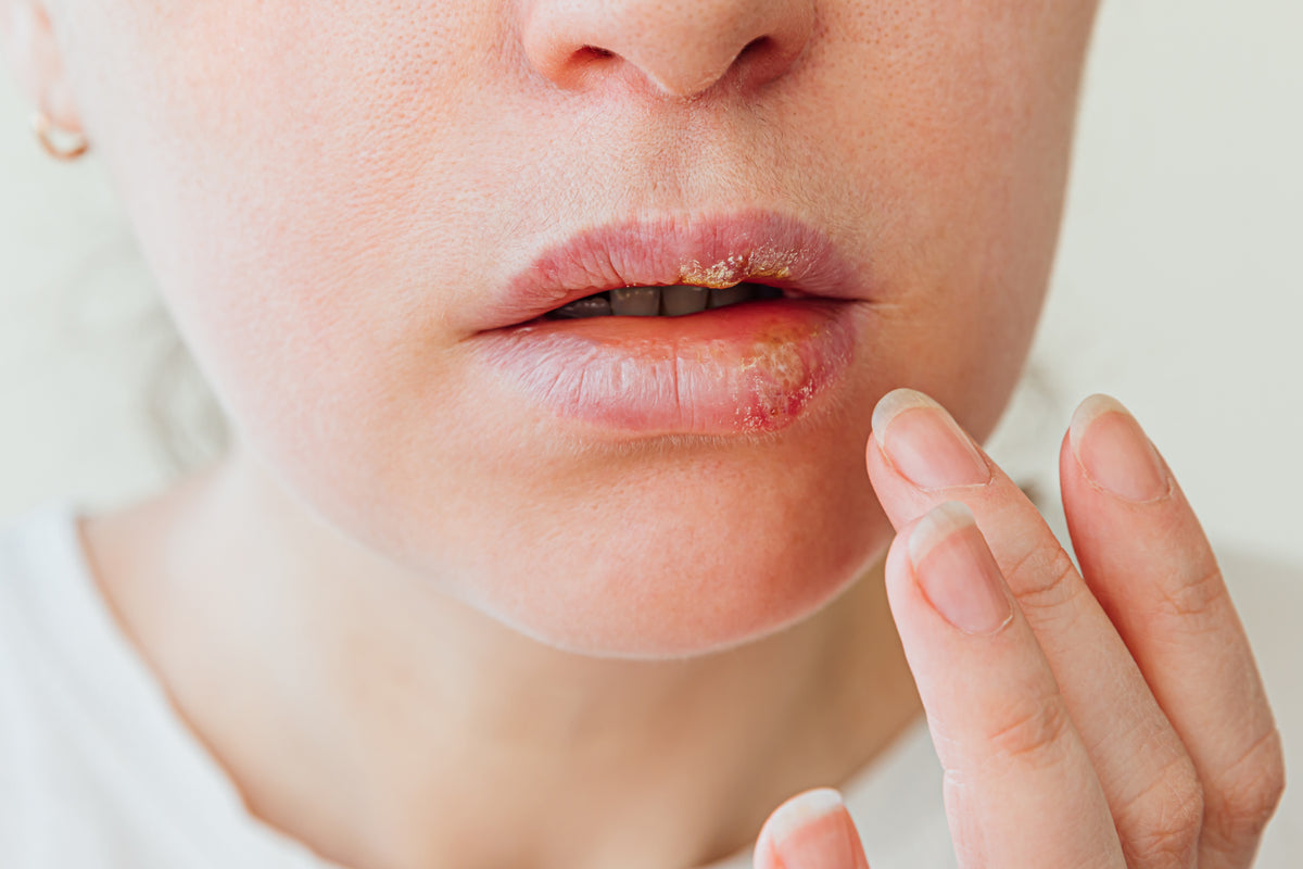beanspruchte Lippen? Mit der natürlichen Pflege von Bienenherz werden diese weich und geschmeidig. Honig und Propolis.