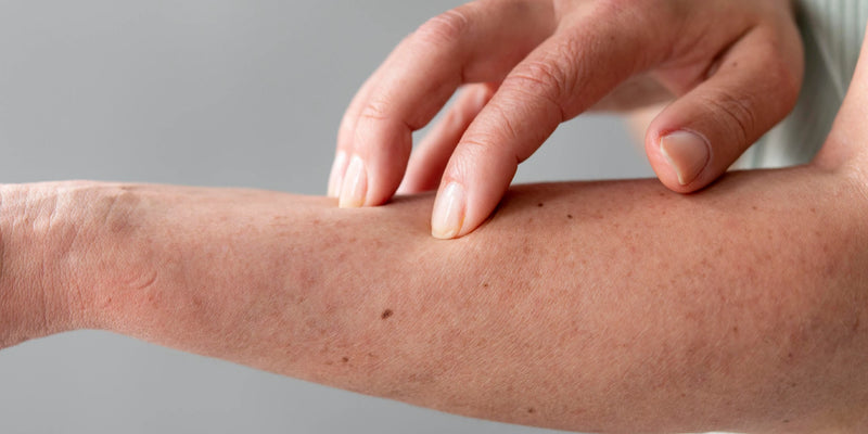 dermatologisch optimierte Pflege